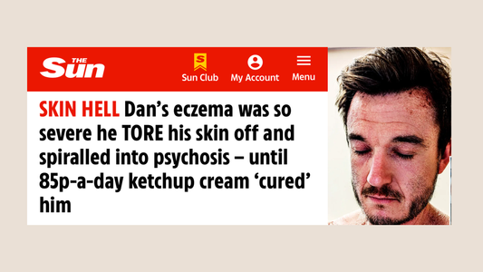 85p a Day 'Ketchup Cream' Helps Eczema! 😱🍅